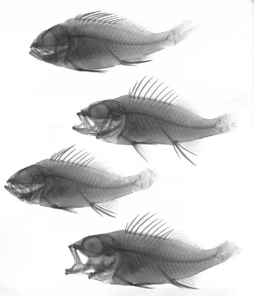 Lepidoperca coatsii (Regan, 1913) - BMNH 1912.7.1.72-76, SYNTYPES, Lepidoperca coatsii, radiograph