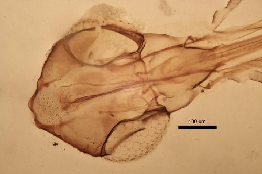 Phlebotomus (Larroussius) aculeatus Lewis et al. - Phlebotomus_aculeatus-010210148-FemaleHead_pharynx-20x_1_6