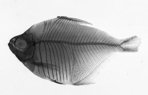 Tetragonopterus compressus Günther, 1864 - BMNH 1854.2.25.6, PARALECTOTYPE, Tetragonopterus compressus, radiograph