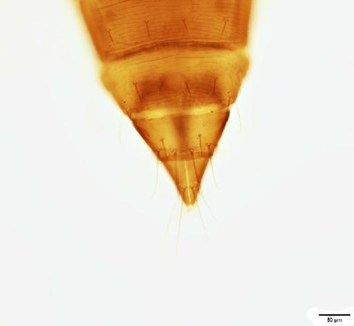 Chirothrips similis Bagnall, 1909 - 012816893_Chirothrips_similis_Lectotype_abdomen_tergites-IX-X