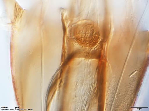 Lutzomyia (Nyssomyia) olmeca olmeca (Vargas & Diaz Najera, 1959) - Lutzomyia_olmeca_nociva-BMNH(E)1722066_PT-female_cibarium-40x.tif