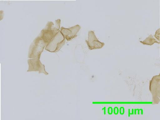 Calopsocus reticuloides Thornton, 1984 - 010138989__2016_03_15-4_s4