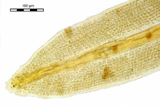 Syrrhopodon gaudichaudii Mont. - Syrrhopodon erectifolius_BM000677468tip2.jp