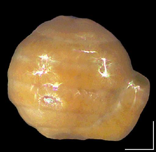 Glomospira charoides (J&P) - ZF4875_Glomospira charoides1_lateral.tif