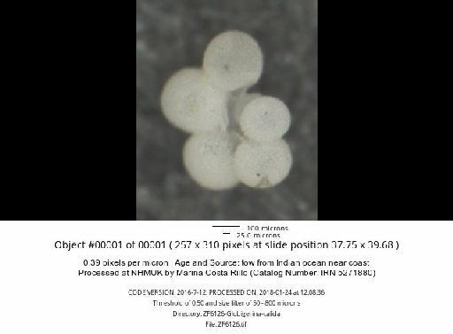 Globigerinella calida (Parker, 1962) - ZF6126-Globigerina-calida_obj00001_plane000.jpg