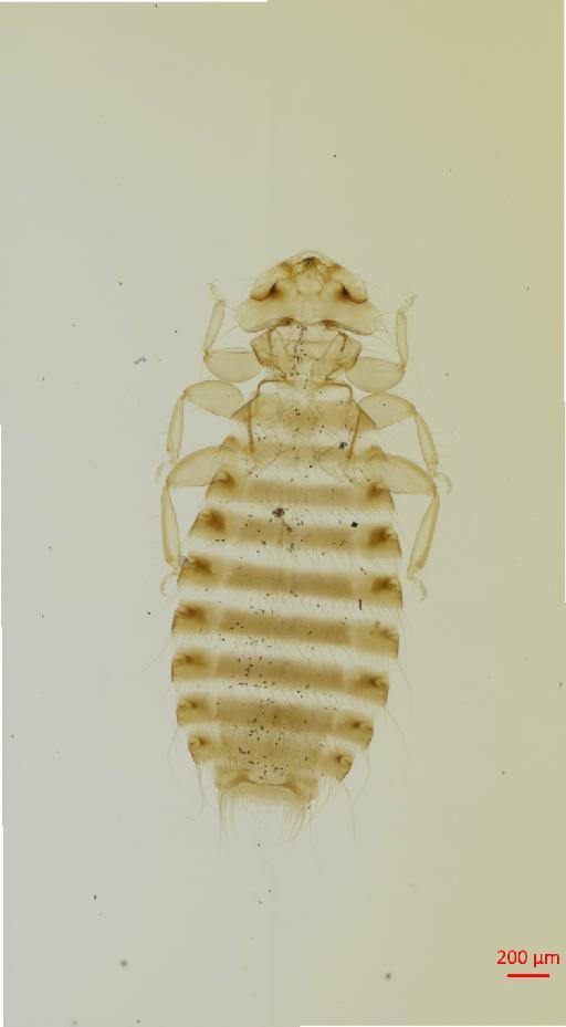 Austromenopon cursorius Giebel, 1874 - 010651810__2017_07_19-Scene-2-ScanRegion1