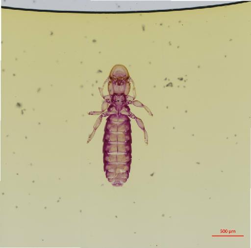 Syrrhaptoecus angulatus Waterston, 1928 - 010694685__2017_08_15-Scene-1-ScanRegion0