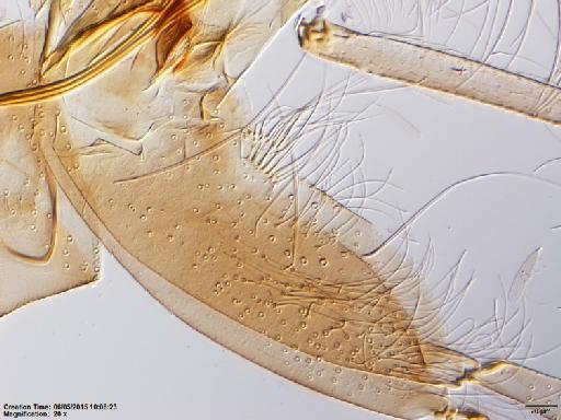 Lutzomyia walkeri species group Migonei Newstead, 1914 - Lutzomyia_walkeri-BMNH(E)1722100_PR-male_gonocoxite-20x.tif