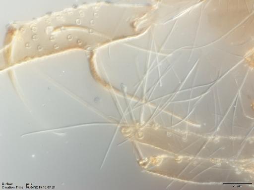 Lutzomyia (Evandromyia) pinottii Damasceno & Arouck, 1956 - Lutzomyia_pinottii-BMNH(E)1721996_PT-male_lateral_lobe-40x.tif