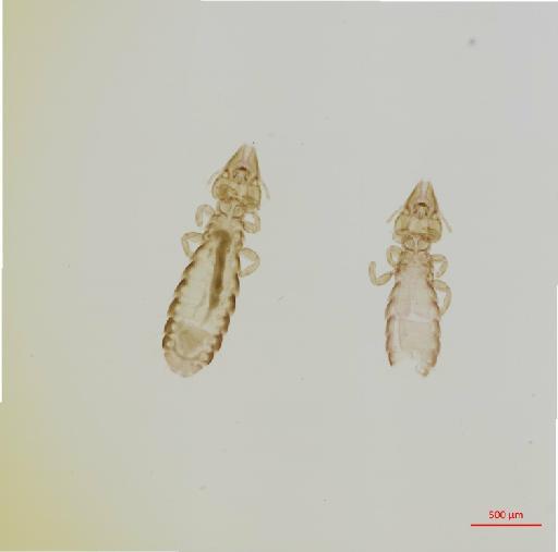 Rallicola (Furnaricola) acutifrons subsimilis Carriker, 1944 - 010690280__2017_08_11-Scene-1-ScanRegion0