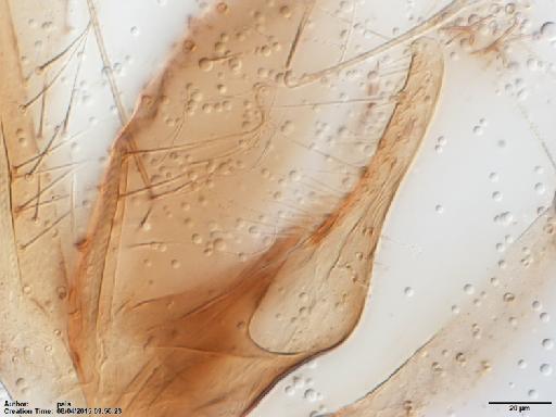 Phlebotomus trinidadensis Newstead, 1922 - Lutzomyia_trinidadensis-BMNH(E)1721999_ST-male_paramere-40x.tif