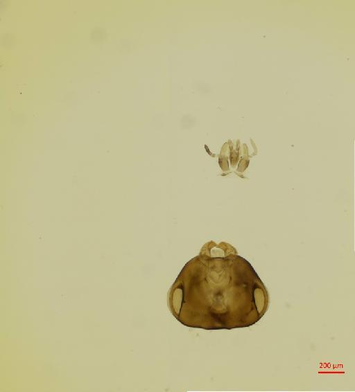 Hexacladia mensia Noyes, 2010 - 010178948__2017_01_31-Scene-4-ScanRegion1