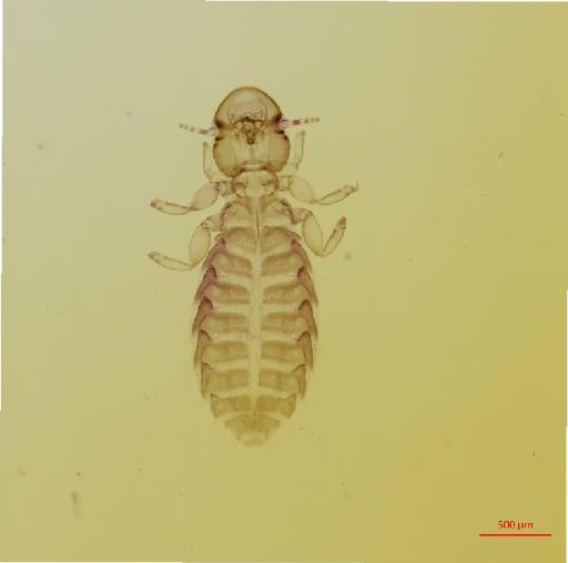 Syrrhaptoecus tibetanus Waterston, 1928 - 010694792__2017_08_15-Scene-1-ScanRegion0