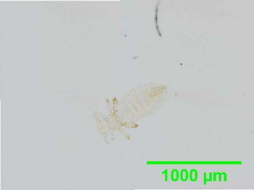 Polyplax jonesi Kellogg & Ferris, 1915 - 010155899__2015_12_22_s1