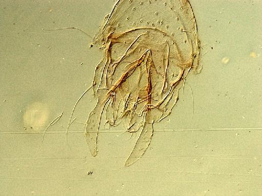 Tanytarsus bifurcus Freeman, 1958 - 010210370-Tanytarsus_bifurcus-genitalia1-DIC-200x