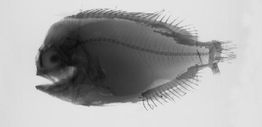 Caristius sp - BMNH 2005.4.28.1, Caristius sp., radiograph