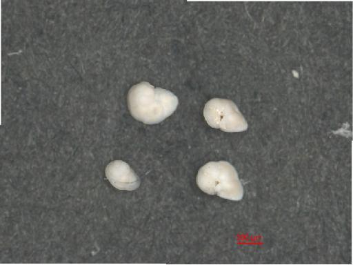 Globorotalia tumida (Brady) - ZF5797