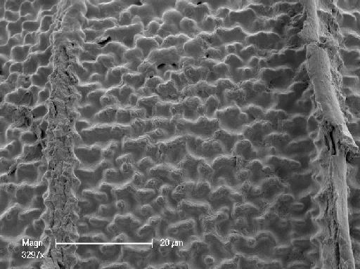 Nitella furcata (C.Roxburgh ex Bruzelius) C.Agardh - OosporeDetail