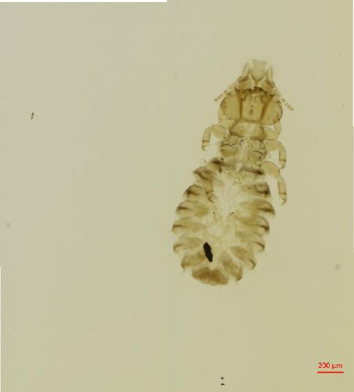 Anatoecus icterodes icterodes Nitzsch, 1818 - 010666967__2017_07_28-Scene-1-ScanRegion0