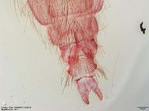 Lutzomyia (Psychodopygus) bispinosa Fairchild & Hertig, 1951 - Lutzomyia_bispinosa-BMNH(E)1251325_PT-female_abdomen-10x.tif