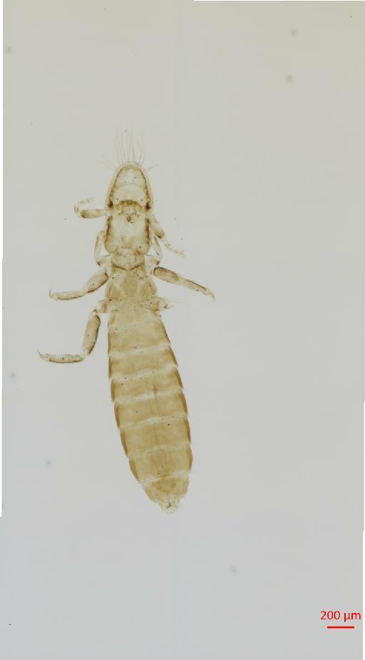 Oxylipeurus ischnocephalus Taschenberg, 1882 - 010682451__2017_08_09-Scene-1-ScanRegion0