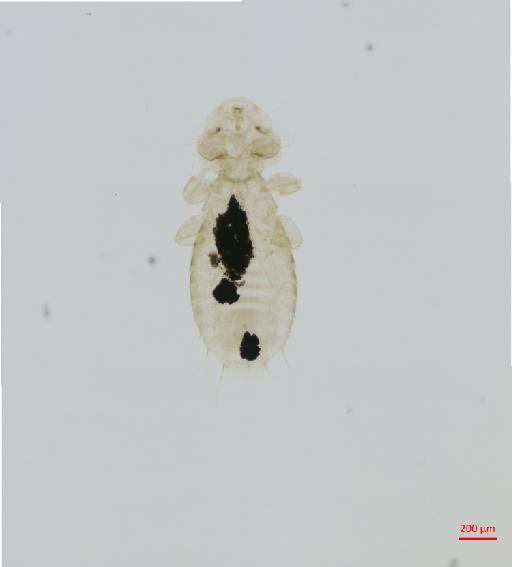 Myrsidea andyolsoni Dalgleish & Price, 2003 - 010661308__2017_07_24-Scene-3-ScanRegion2