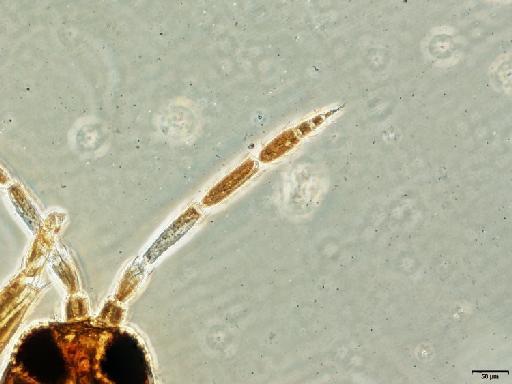Aeolothrips intermedius Bagnall, 1934 - 010153697_Aeolothrips_intermedius_Lectotype_antenna