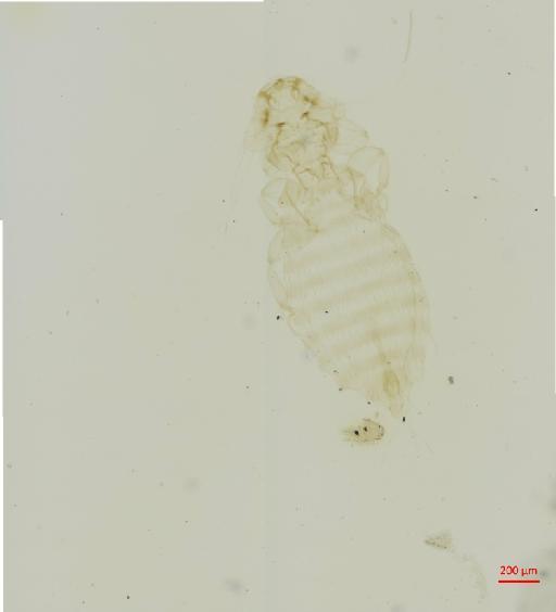 Menacanthus falcatus colinus Carriker, 1946 - 010658079__2017_07_24-Scene-3-ScanRegion2