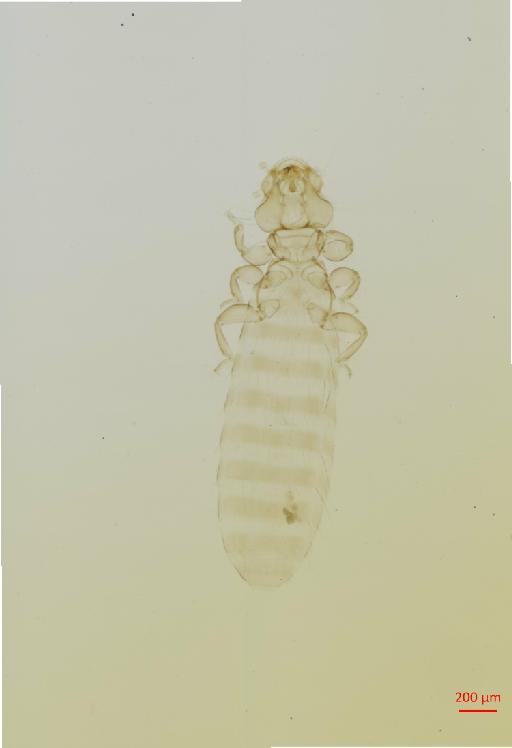 Actornithophilus sabulosus Clay, 1962 - 010650413__2017_07_18-Scene-1-ScanRegion0