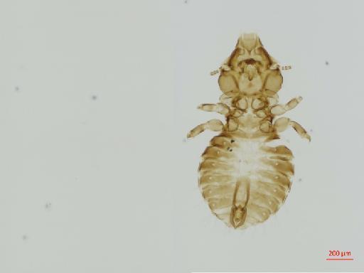 Saemundssonia nivea Timmermann, 1956 - 010690864__2017_08_11-Scene-2-ScanRegion1