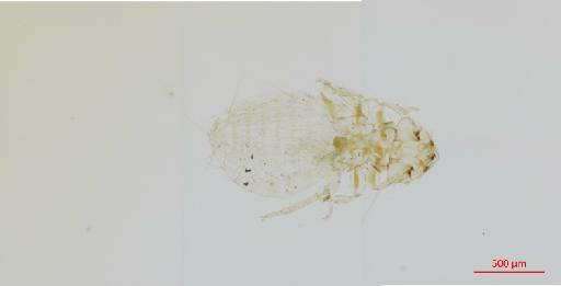 Holomenopon tumidum Piaget, 1885 - 010657478__2017_07_21-Scene-1-ScanRegion0