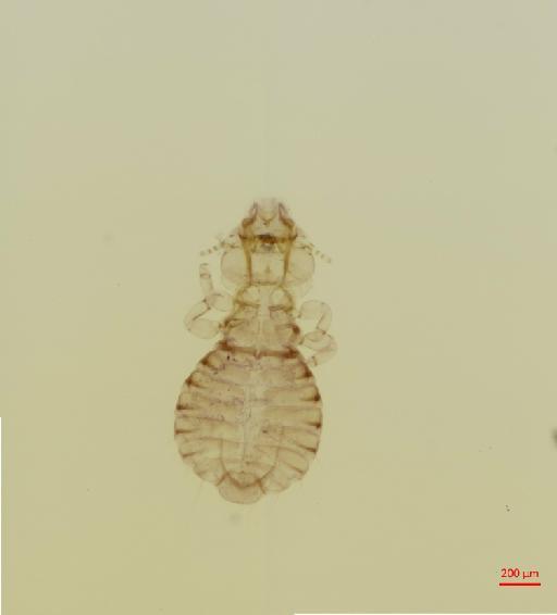 Anatoecus dentatus parviclypeatus Keler, 1960 - 010666852__2017_07_28-Scene-1-ScanRegion0
