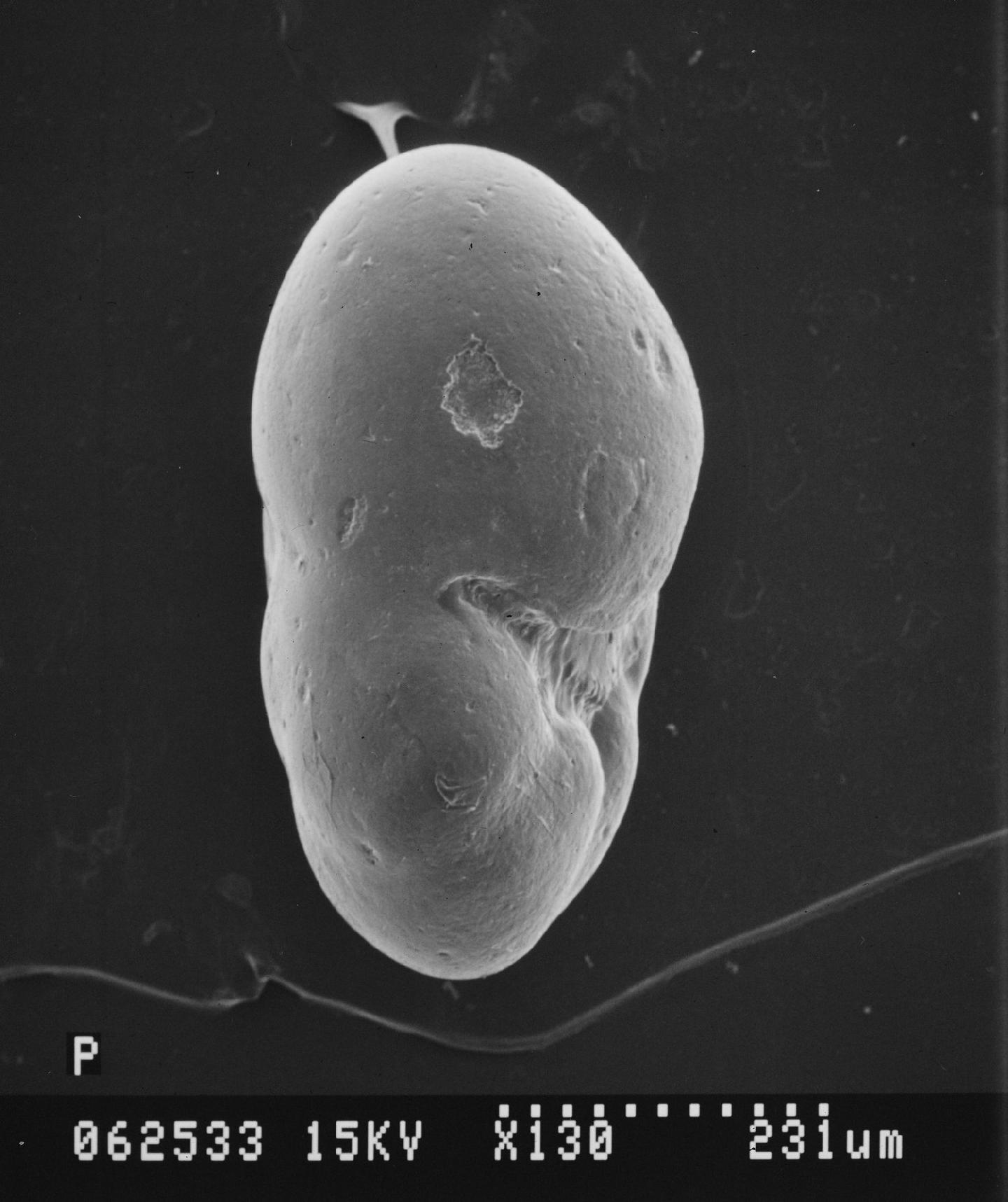 To NHMUK collection (Valvulineria esnehensis Nakkady, 1950; Holotype; NHMUK:ecatalogue:2368648)