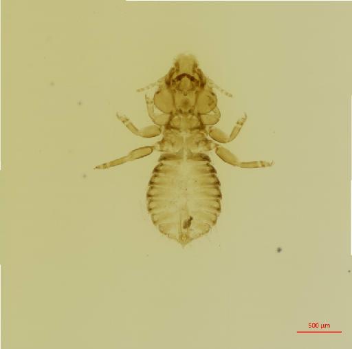 Neophilopterus sarae Tendeiro, 1958 - 010678693__2017_08_08-Scene-2-ScanRegion1