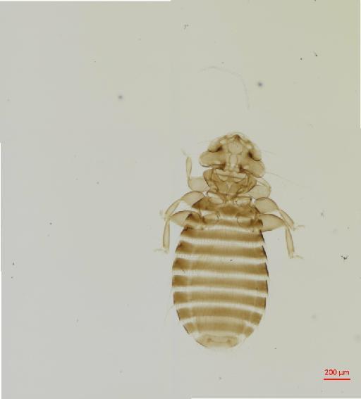 Austromenopon atrofulvum Piaget, 1880 - 010651673__2017_07_19-Scene-1-ScanRegion0