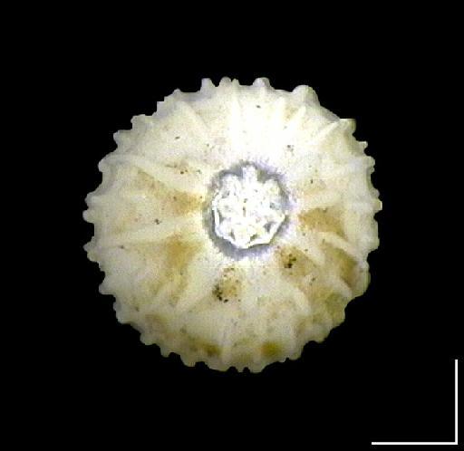 Polymorphina myristiformis Williamson, 1858 - ZF2144_Globulina myristiformis2_apertural.tif