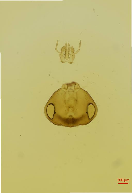 Hexacladia eda Noyes, 2010 - 010178960__2017_01_31-Scene-4-ScanRegion3