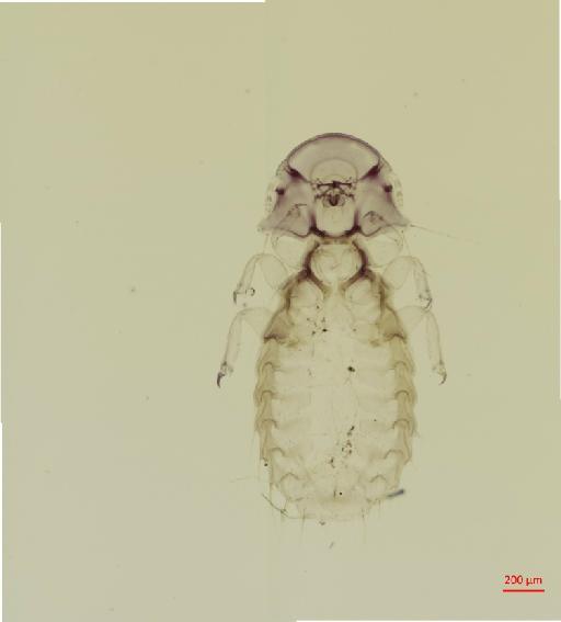 Coloceroides indicus Tendeiro, 1973 - 010671885__2017_08_01-Scene-1-ScanRegion0