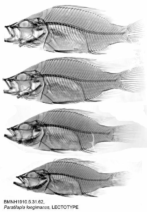 Paratilapia longimanus Boulenger, 1911 - BMNH 1910.5.31.62, Paratilapia longimanus, LECTOTYPE, Radiograph