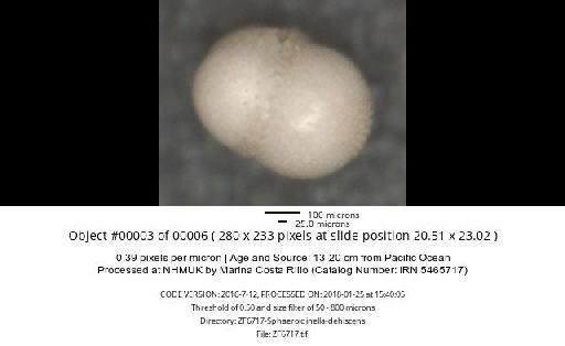 Sphaeroidinella dehiscens (Cushman) - ZF6717-Sphaeroidinella-dehiscens_obj00003_plane000.jpg