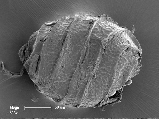 Nitella gelatinifera (R.D.Wood) R.D.Wood - OosporeSide