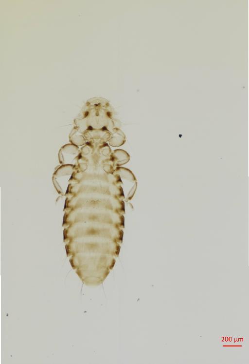 Actornithophilus crinitus Clay, 1962 - 010649804__2017_07_18-Scene-1-ScanRegion0