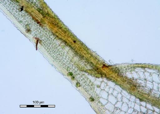 Syrrhopodon confertus Sande Lac. - Syrrhopodon ameonus_BM000672704margin cells.jpg