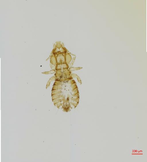 Anatoecus icterodes boschadis Keler, 1960 - 010666896__2017_07_28-Scene-2-ScanRegion1