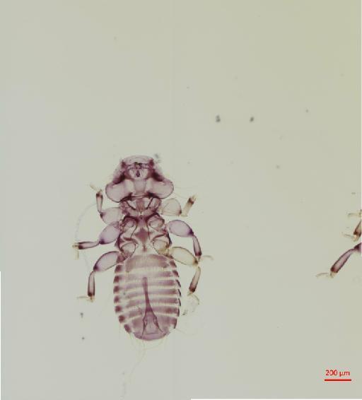 Myrsidea grandiceps macrorhynchicola Klockenhoff, 1971 - 010661949__2017_07_24-Scene-1-ScanRegion0