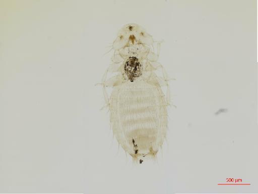 Pseudomenopon stresemanni Eichler, 1949 - 010663586__2017_07_26-Scene-1-ScanRegion0