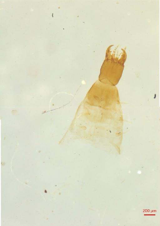 Histeridae Gyllenhal, 1808 - 010133290___1