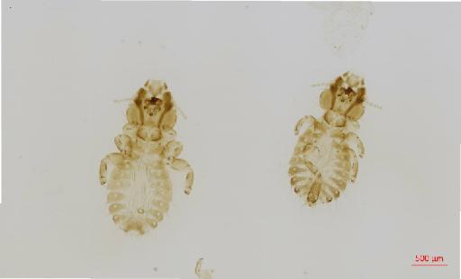 Strigiphilus varius Carriker, 1958 - 010693912__2017_08_11-Scene-1-ScanRegion0