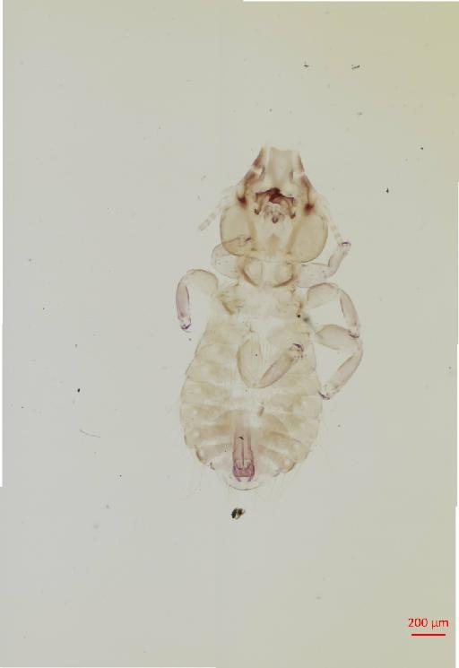 Strigiphilus ketupae Emerson & Elbel, 1957 - 010693542__2017_08_11-Scene-1-ScanRegion0