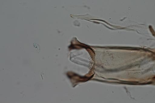 Simulium (Trichodagmia) brachycladum species group Tarsatum Lutz & Pinto, 1932 - 010195930_Simulium_Trichodagmia_brachycladum_cibarium